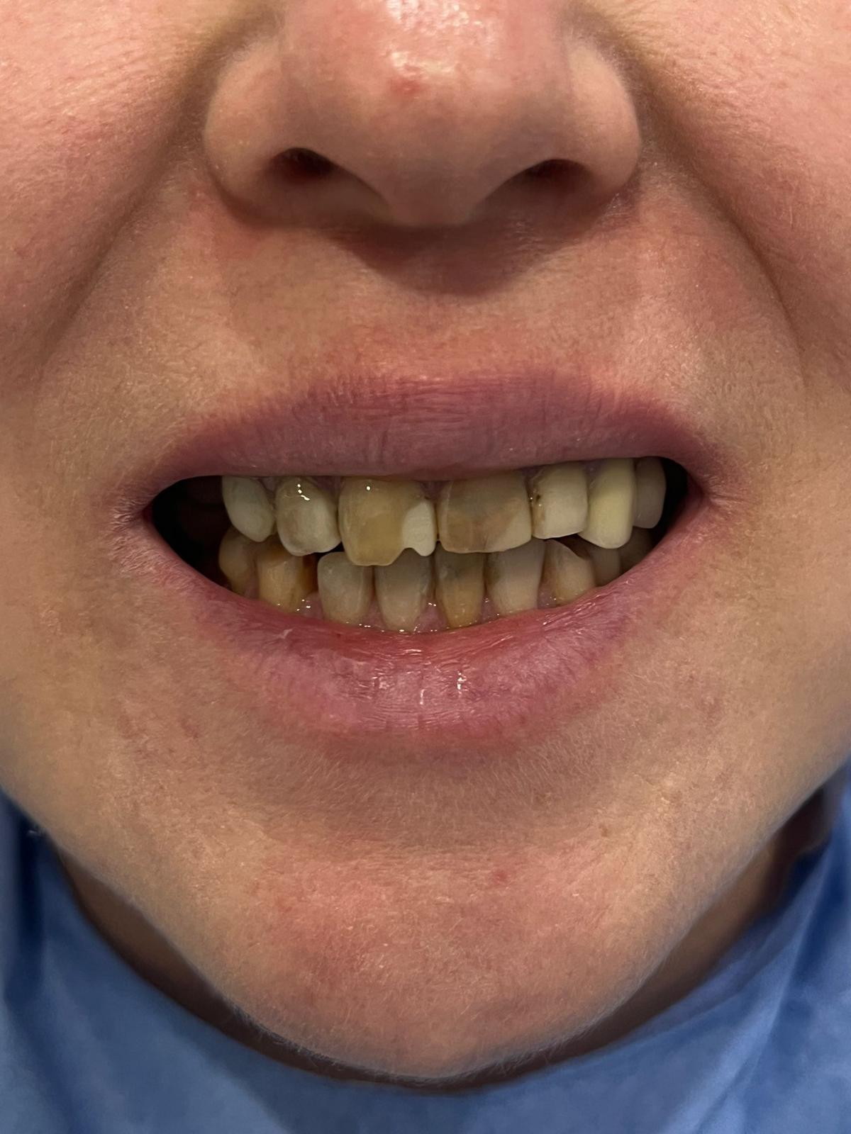 ECE Dental Patient Transformation